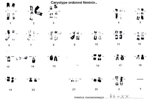 Caryotype