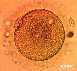 Ovule